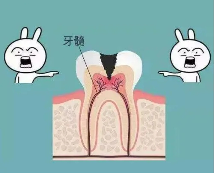 做完根管治疗后，如果疼痛怎么办？