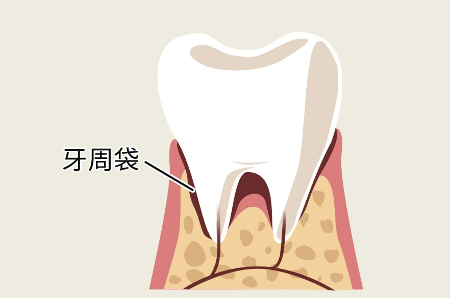 牙齿矫正的最佳年龄：把握关键阶段，开启健康笑容之旅