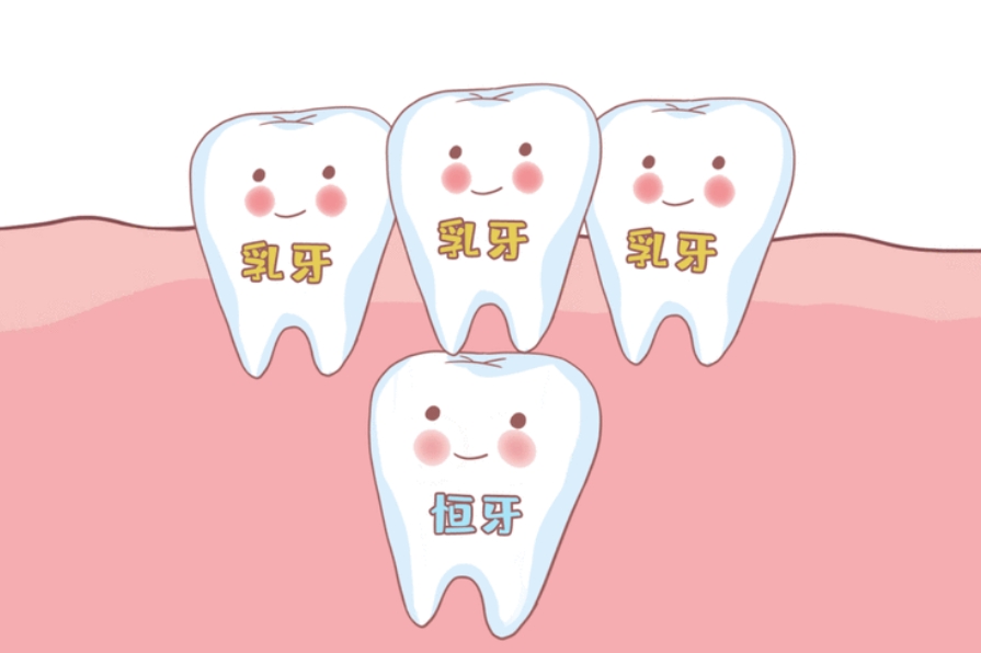 牙齿矫正后为什么会出现黑三角？