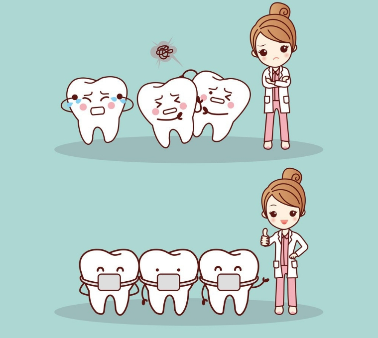 种植牙与天然牙，谁能承受更多咀嚼力？