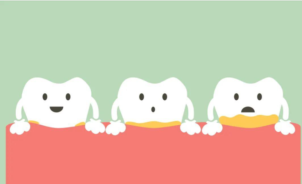 氟斑牙、四环素牙，做贴面有用吗？