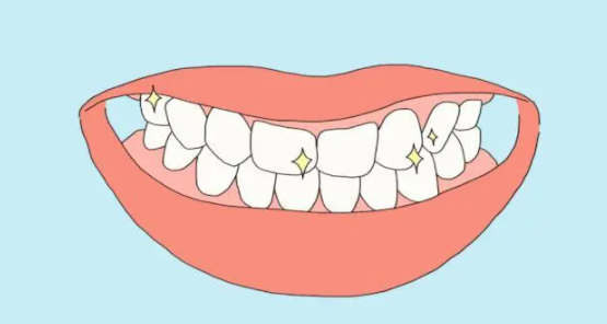 种植牙与真牙的区别有哪些？