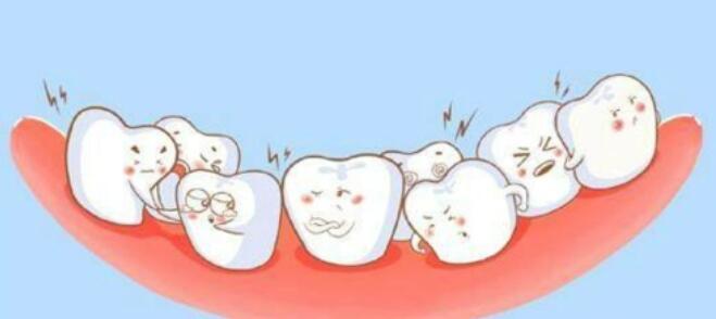 为什么种植牙和邻牙之间会塞牙?