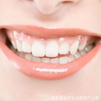 什么是牙贴面？什么是牙冠修复？