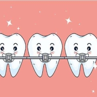 佩戴橡皮筋的关键注意事项有哪些？