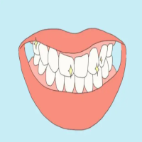 牙根会越来越长，越来越细了是怎么回事呢？