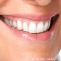 什么样的牙齿适合通过贴面改善？